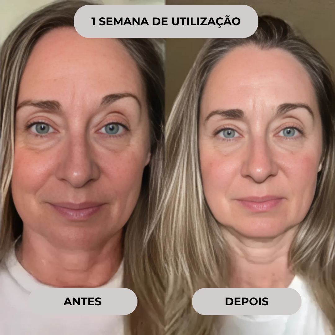 Mini kit de microinfusão facial de soro anti-envelhecimento