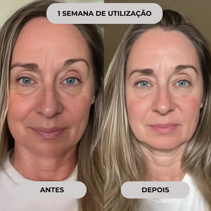 Mini kit de microinfusão facial de soro anti-envelhecimento