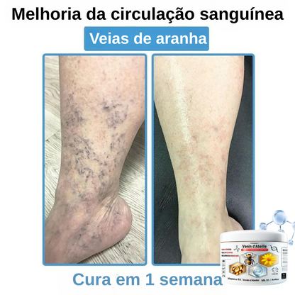Creme anti-inflamatório multi-sintomas com veneno de abelha (OFERTA 2X1)
