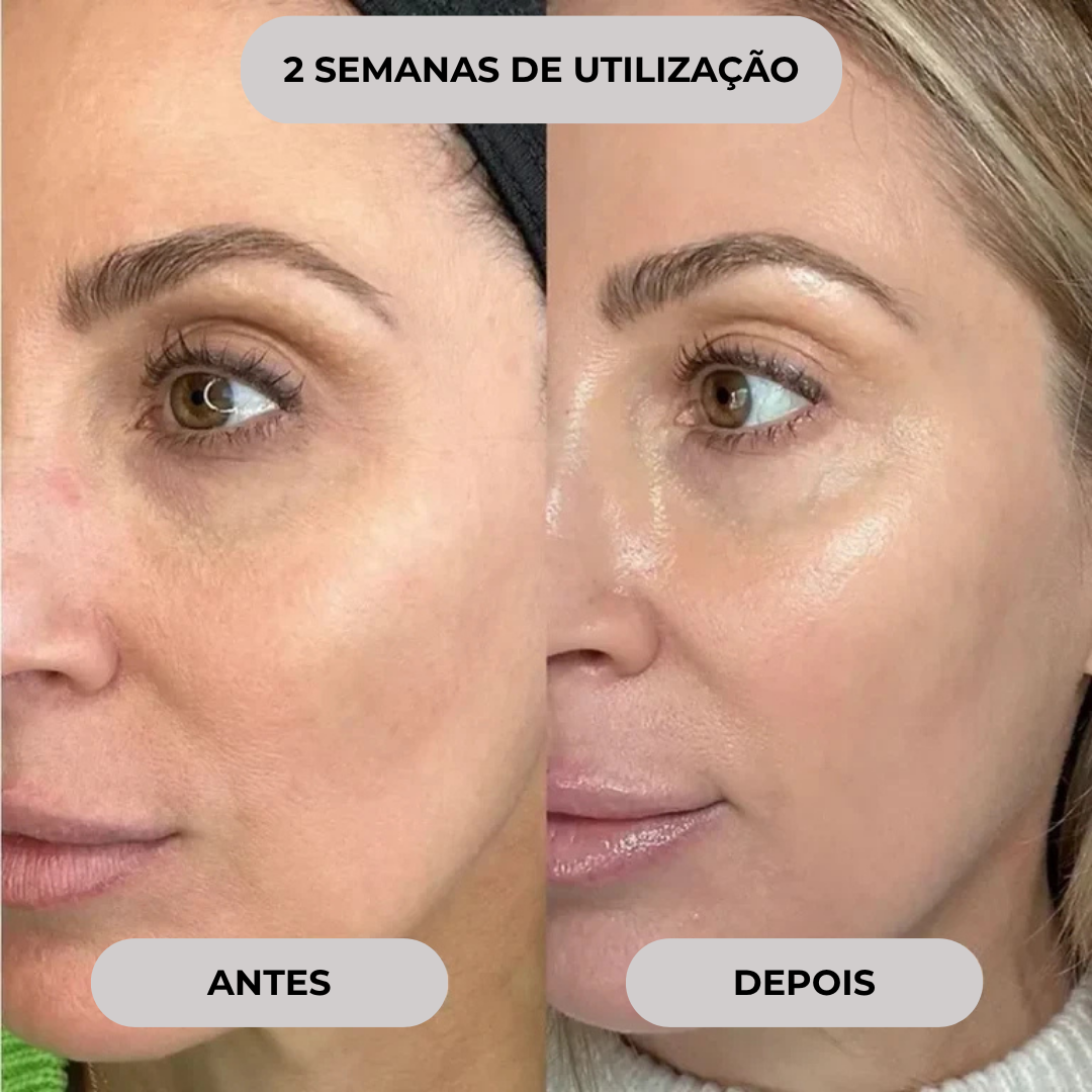 Mini kit de microinfusão facial de soro anti-envelhecimento