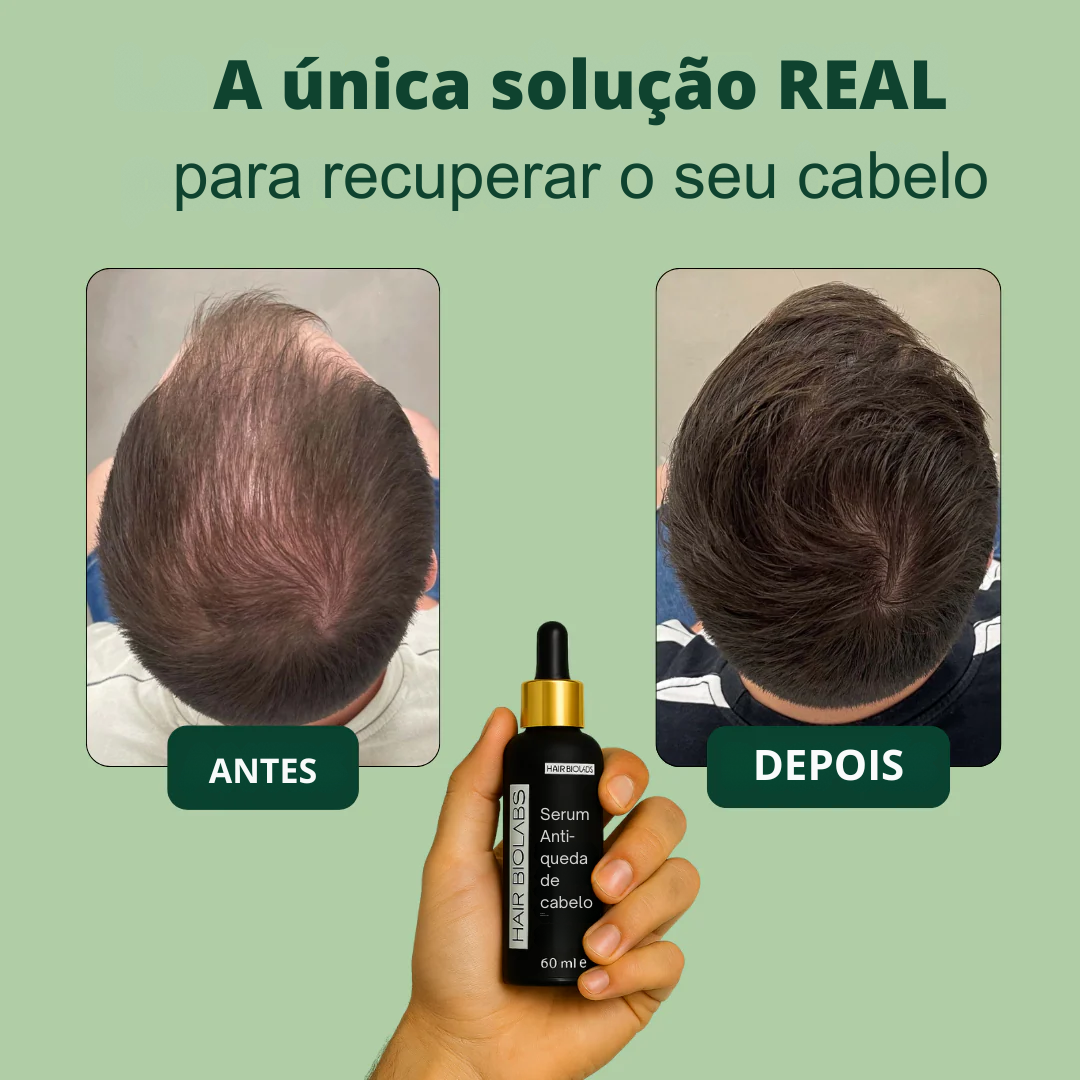 Sérum anticaída para cabelos - HAIR BIOLABS 60 ml (PROMOÇÃO 2X1)