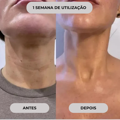 Mini kit de microinfusão facial de soro anti-envelhecimento
