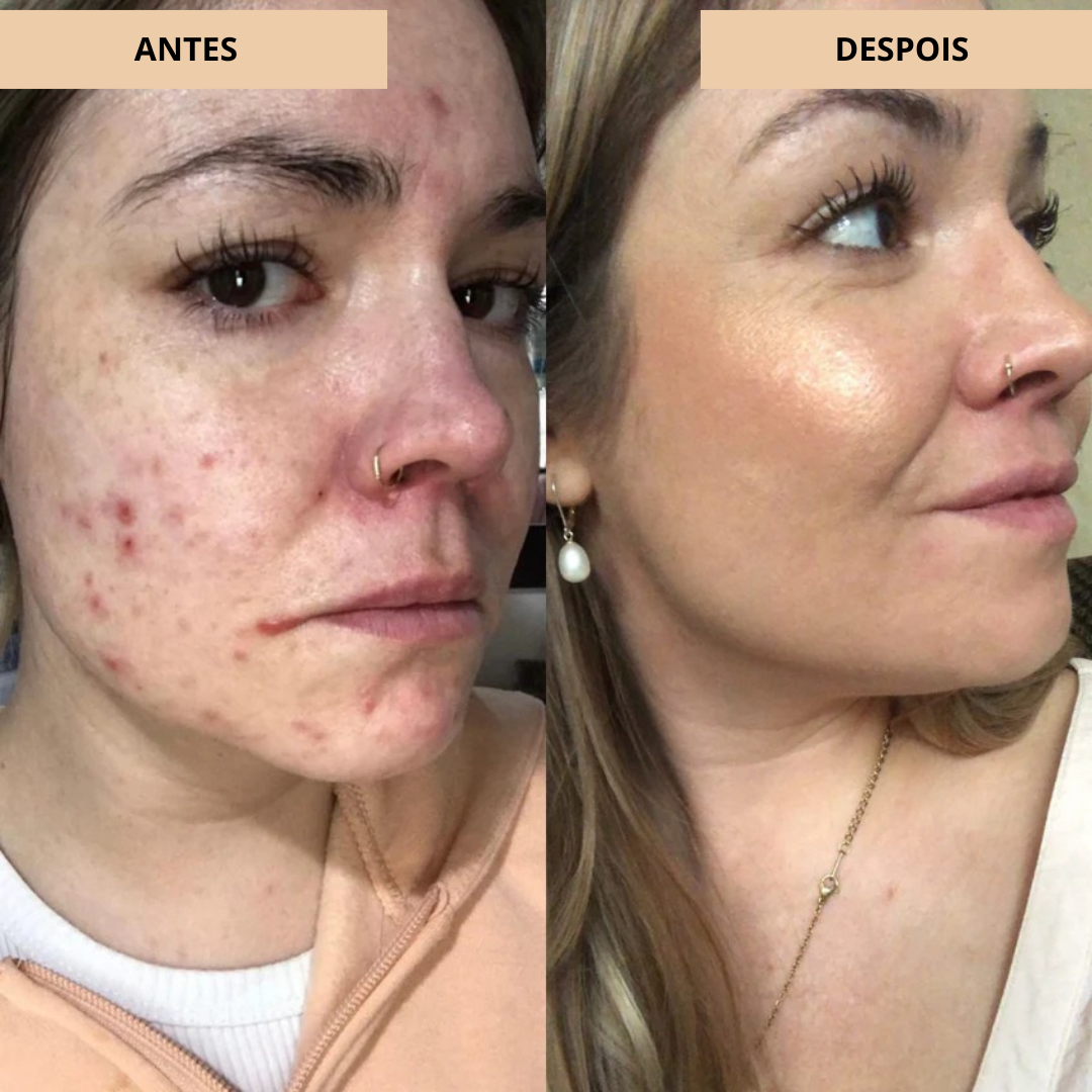 Fórmula em Creme Leve e Hidratante para um Acabamento Radiante e Natural