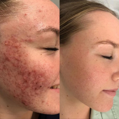 Sérum Hidratante com Ácido Hialurónico