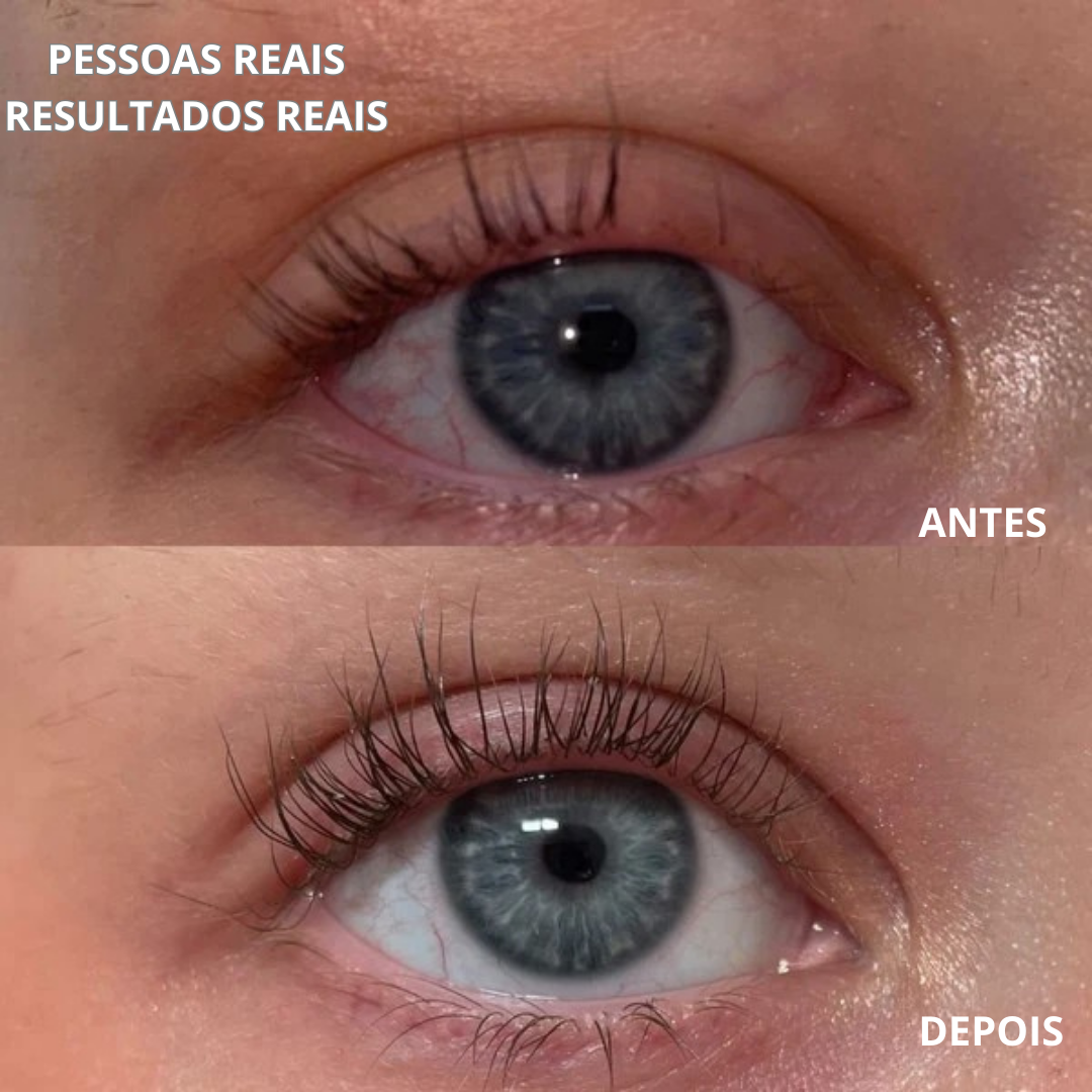 Sérum Para Crescimento dos Cílios (EM PROMOÇÃO 2X1)