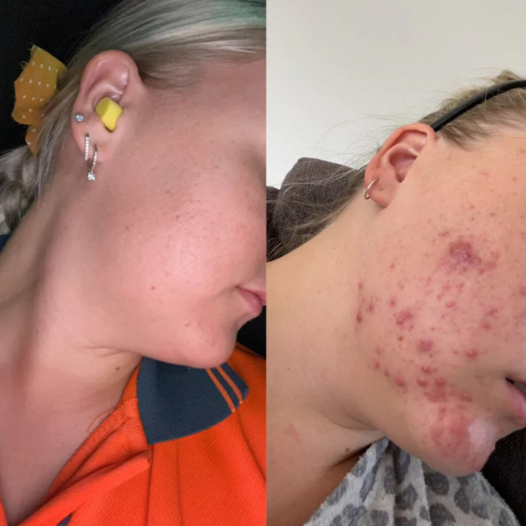 Sérum Hidratante com Ácido Hialurónico