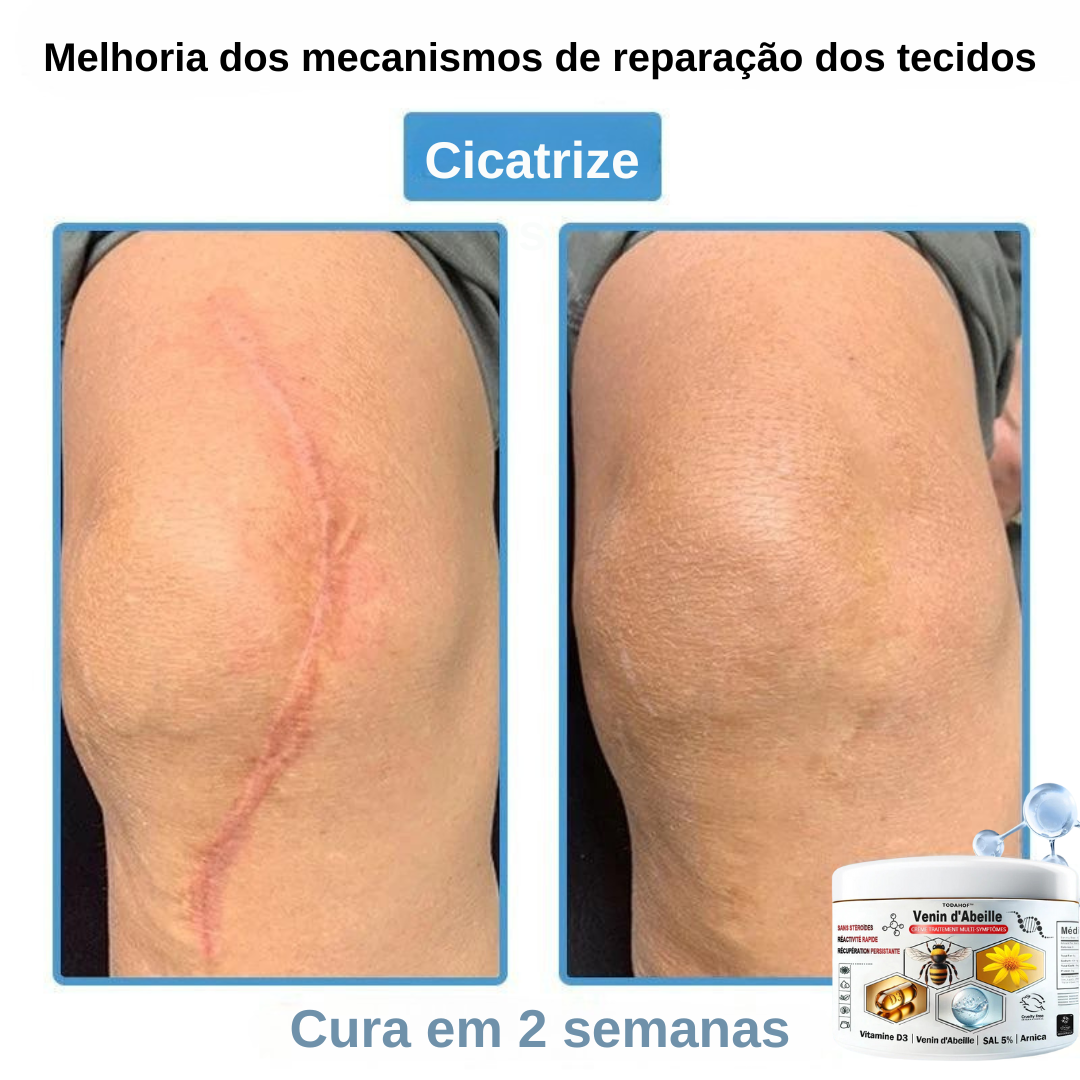 Creme anti-inflamatório multi-sintomas com veneno de abelha (OFERTA 2X1)