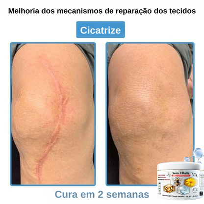 Creme anti-inflamatório multi-sintomas com veneno de abelha (OFERTA 2X1)