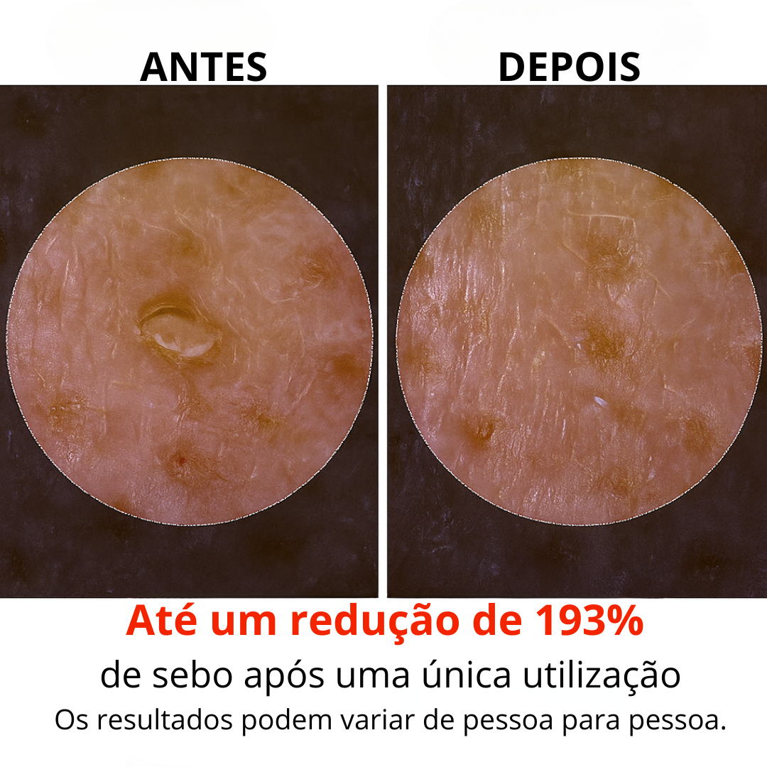 Serum facial de arroz para uma esfoliação suave e uma luminosidade natural (2X1 OFERTA)