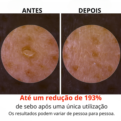 Serum facial de arroz para uma esfoliação suave e uma luminosidade natural (2X1 OFERTA)